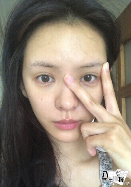 张予曦回应外貌争议,张予曦黑历史盘点脖子上吻痕是怎么回事?(图5) 图片